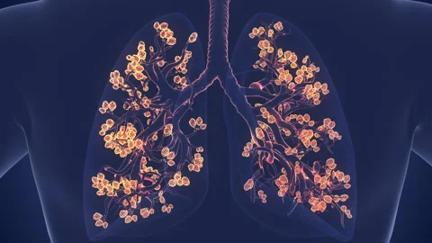 Alveoli Supporting Breathing Inside Human Lung Structure Stock Footage 289550678