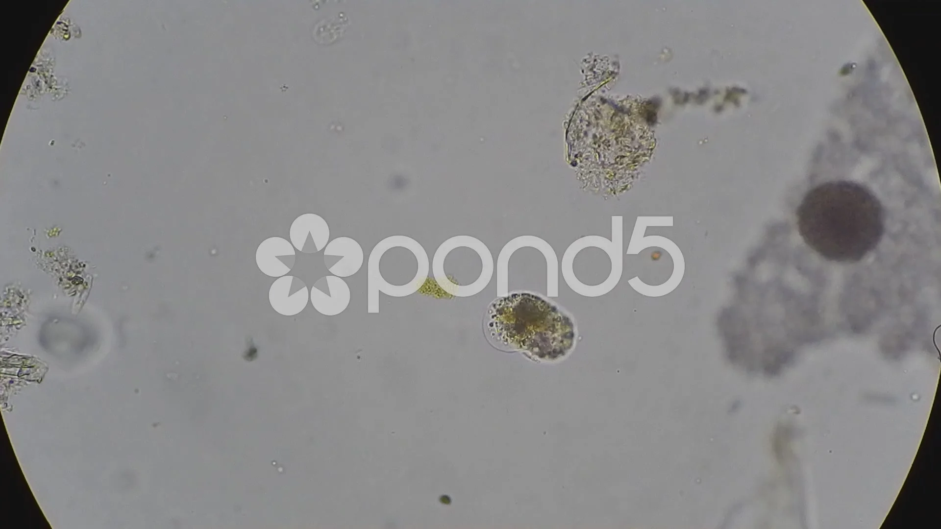 amoeba under microscope labeled