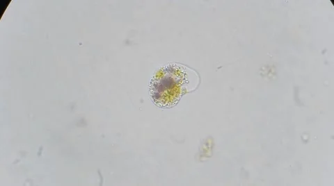 Ameba under microscope, magn 400x Stock-Footage 44647021