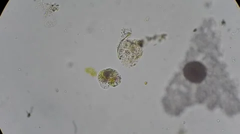 Ameba under microscope, magn 400x Stock-Footage 45597569
