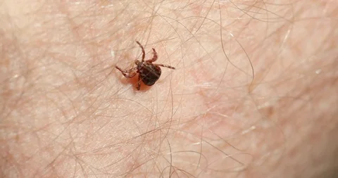 American Dog Tick Stock Footage 107679613