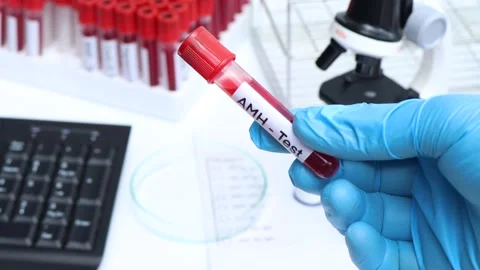 AMH test to look for abnormalities from ... | Stock Video | Pond5