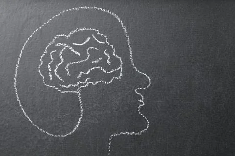Amnesia problem. Drawing of head and brain on black background, top view. S.. 스톡 사진