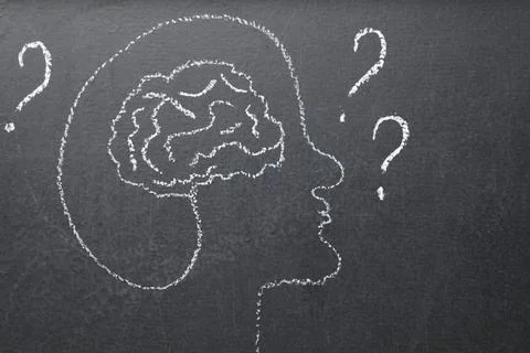 Amnesia problem. Drawing of head, brain and question marks on black backgro.. Stock Photos