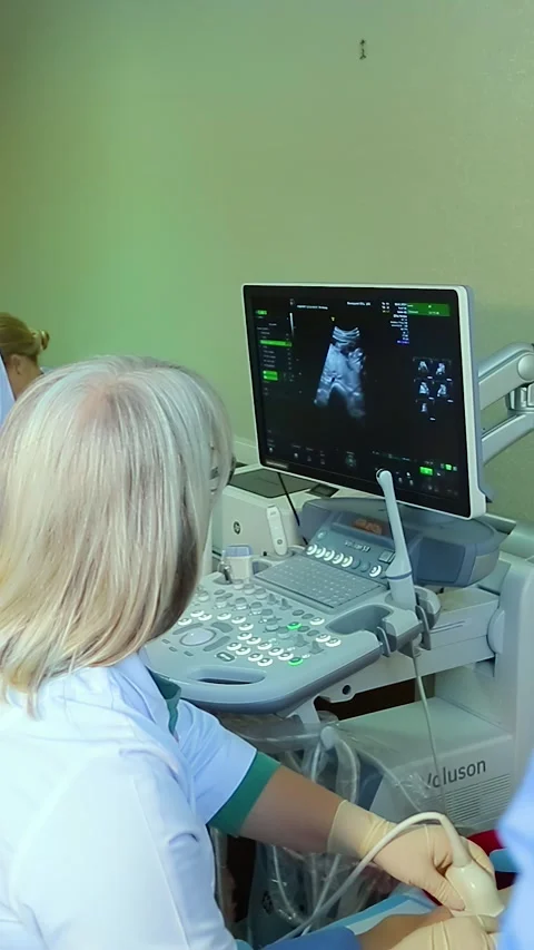 Amniocentesis. Amniotic fluid test. Video stock 269645744