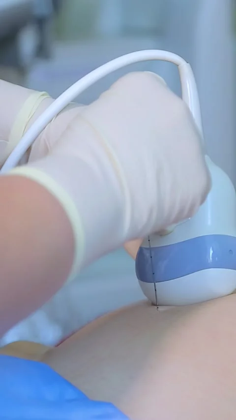 Amniocentesis. Vertical video. Stock Footage 269202673