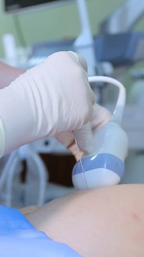 Amniocentesis. Vertical video. Stock Footage 269202708