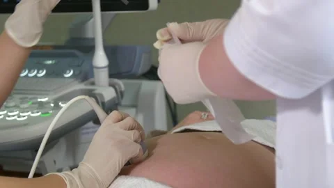 Amniotic fluid test. Amniocentesis. Stock Footage 269022677