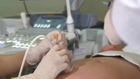 Amniotic fluid test. Amniocentesis. Stock Footage 269022741