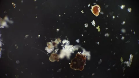 Amoeba and microbes seen through microscope, accelerated footage shows acti.. Stock Footage 308784733