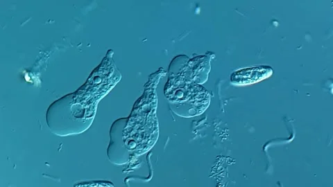 Amoeba and spirochetes under microscope 库存影片 306591239