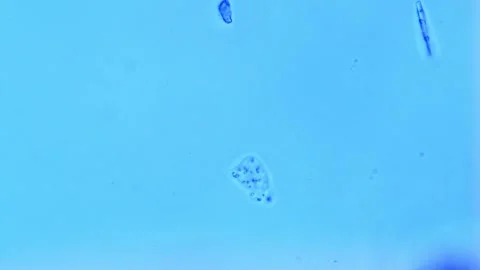 Amoeba crawling under brightfield microscope-400X magnification Stock Footage 303016790
