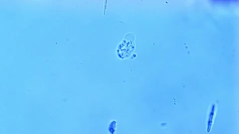 Amoeba in freshwater under brightfield microscope - 400X Stock Footage 303038947