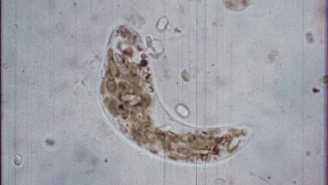 Amoeba Germ Parasite Microscope Cell Microorganism Movie Vintage Film Old Stock Footage 118800196