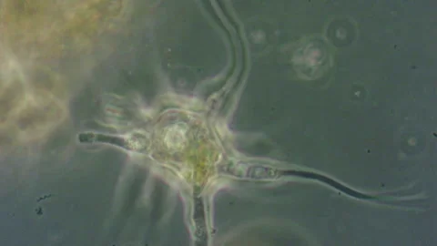 Amoeba with long pseudopodia among. Stock Footage 324566518