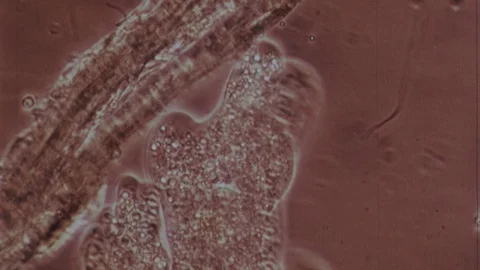 Amoeba Microscopic Microscope Cell Microorganism Biology Vintage 16mm Film Movie Vidéo 88261543