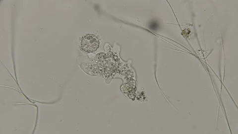 The amoeba parasite in motion, under a microscope Vídeos de archivo 92446459