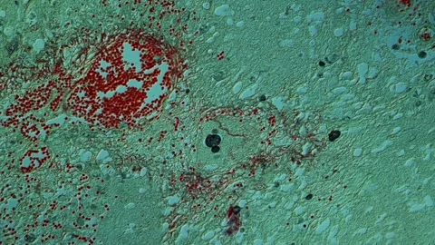 Amoeba parasite tissue under the microscope Video stock 343541326