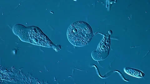 Amoeba in pond water under microscopy view 库存影片 306579779