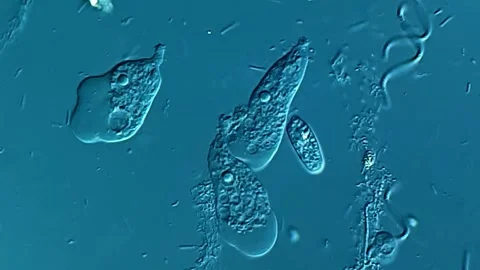 Amoeba under DIC microscope view 400x 库存影片 306588835