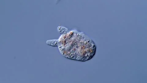 Amoeba under DIC microscope view 库存影片 310312301