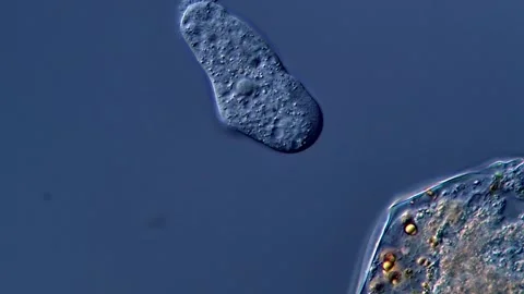 Amoeba under DIC microscope view 库存影片 310313710