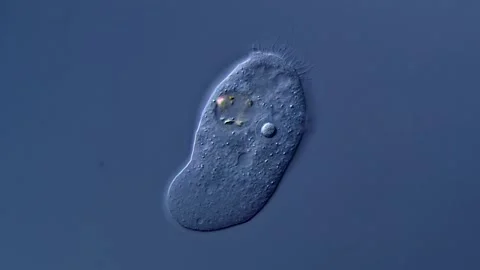 Amoeba under DIC microscope view 스톡 동영상 310316282