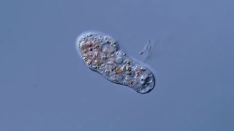 Amoebae under microscope, water sample Vídeos de archivo 310312071