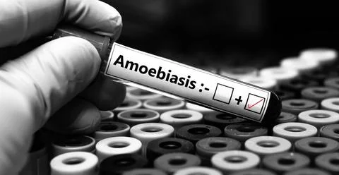 Amoebiasis + Stock Photos
