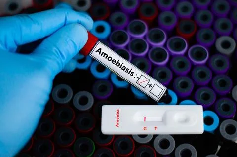 Amoebiasis - 스톡 사진