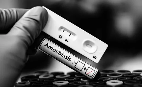 Amoebiasis + Stock Photos