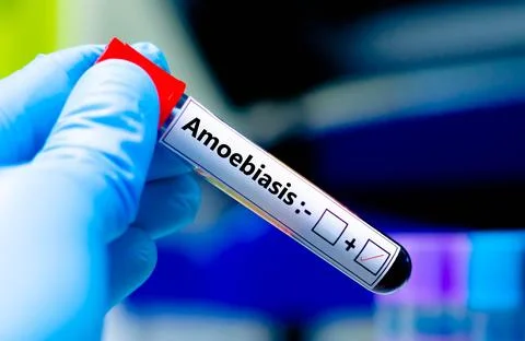 Amoebiasis + Stock Photos