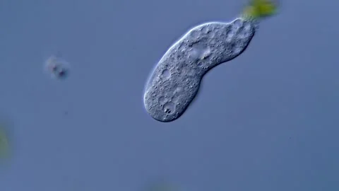Amoeboid under microscopy view 库存影片 310311920