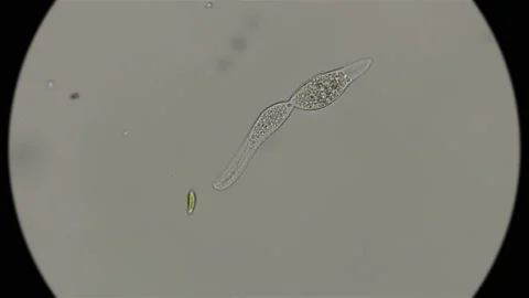 Amphileptus infusoria trying to split under a microscope Stock Footage 93254737