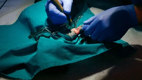 Amputation Stock Footage 120868022