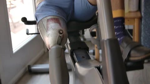 Amputee close up doing physical therapy on bike Stock Footage 287499222