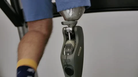 Amputee man walking on treadmill Stock Footage 287248039