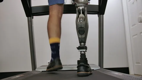 Amputee missing leg walking on treadmill Stock Footage 287412566