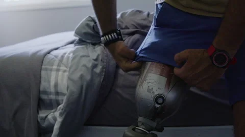 Amputee pulling shorts over prosthetic Stock Footage 289003470