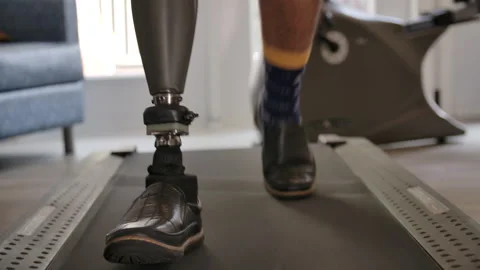 Amputee on treadmill doing workout Stock Footage 287058465