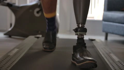Amputee walking on a treadmill Stock Footage 288811936