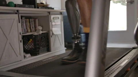 Amputee walking on treadmill at home Stock Footage 288289654