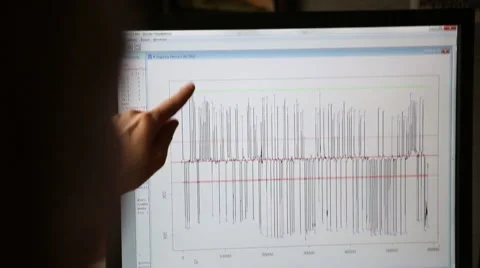 Analayizing brain waves in graph on computer Stock Footage 49679158