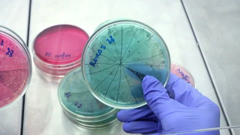 Analisis PetryDish Stock Footage 105341797