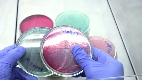 Analisis PetryDish_Red Stock Footage 105341751