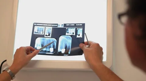 Analizing  radiography Stock Footage 65368875