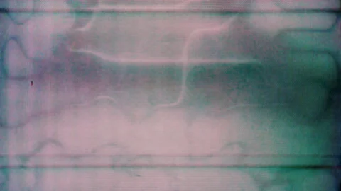 Analog noise surface Noise, flicker, offset, black and white, monochrome TV effe Video stock 149181358