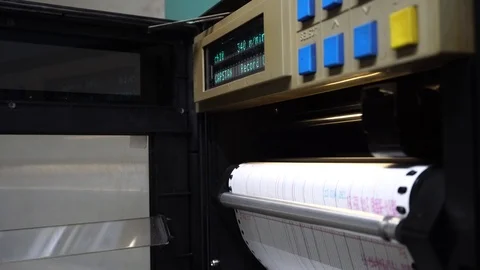Analog recorder printing ink into graph paper. Stock Footage 104613246