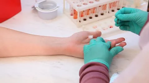 Analysis of blood Stock Footage 10789552