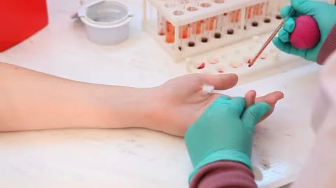 Analysis of blood Stock Footage 10789573